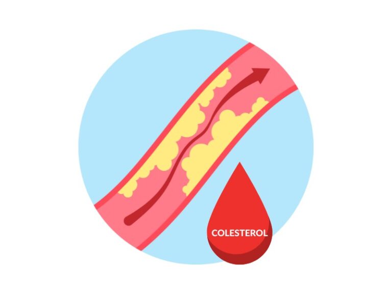 mituri despre colesterol, colesterol bun, colesterol rau, vitamina care scade colesterolul, leacuri batranesti pentru scaderea colesterolului, bauturi care scad colesterolul
