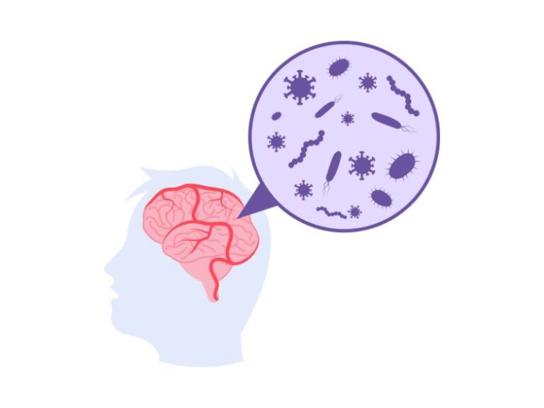 encefalita, encefalita simptome, encefalita virala, encefalita herpetica, ce este encefalita, cat dureaza encefalita, tratament encefalita, encefalita autoimuna, encefalita la copii, simptome encefalita adulti, sechele encefalita, recuperare dupa encefalita, ce inseamna encefalita, encefalita este contagioasa, simptome encefalita copii