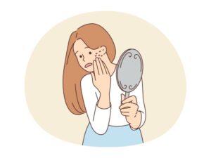 acnee hormonala, acneea hormonala, acnee hormonala tratament, tratament acnee hormonala, tratament naturist acnee hormonala, pastile pentru acnee hormonala, crema acnee hormonala, cosuri pe frunte, cosuri pe gat si maxilar cauze, analiza hormonale acnee, cosuri pe barbie