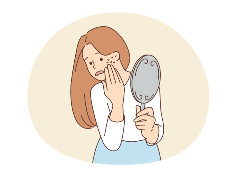 acnee hormonala, acneea hormonala, acnee hormonala tratament, tratament acnee hormonala, tratament naturist acnee hormonala, pastile pentru acnee hormonala, crema acnee hormonala, cosuri pe frunte, cosuri pe gat si maxilar cauze, analiza hormonale acnee, cosuri pe barbie